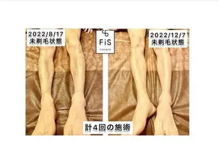 脱毛サロン＆ハーブピーリングFIS戸塚店所属・西内 【FIS】のエステ・リラクイメージ