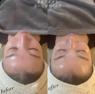 うなじ脱毛/美肌脱毛 LABELのエステ・リラクイメージ