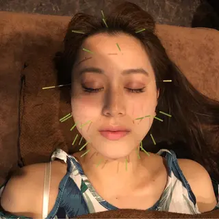 美容鍼灸サロン LOMIHARIのエステ・リラクイメージ