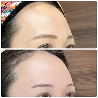 小顔/たるみ/黒ずみ除去専門サロン/SONA 大和西大寺店所属・【小顔専門看護師 サロンSONA】のエステ・リラクイメージ