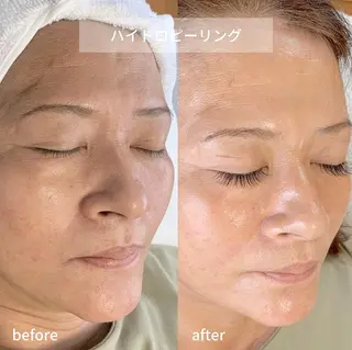 メンズ salonLADYSTYLE所属・稲嶺 美華のエステ・リラクイメージ