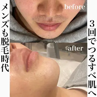 beauty salon by BMbm所属・名倉 彩乃のエステ・リラクイメージ