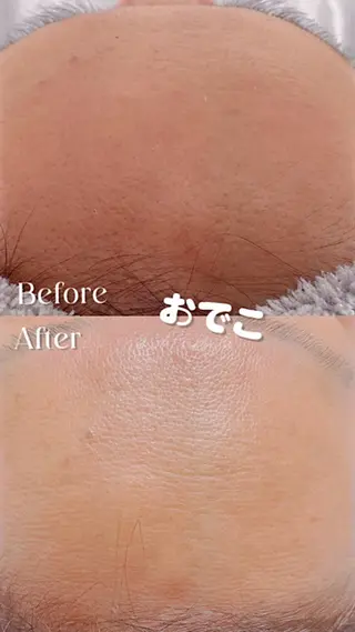 Hit. シュガーリング豊橋のエステ・リラクイメージ