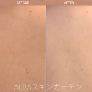 ALBAスキンガーデン所属・ALBA🌱 yuriのエステ・リラクイメージ