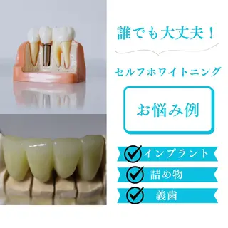 メンズ ショート ホワイトニングサロン nico西葛西店のその他イメージ