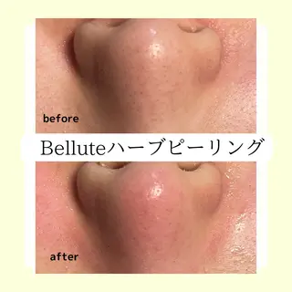 ピーリング専門店 Belluteのエステ・リラクイメージ