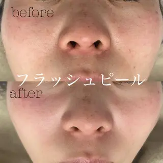 メンズ フェイシャルサロン CHIARA 荒田のエステ・リラクイメージ