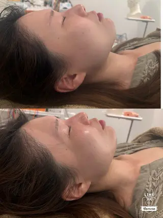 美容鍼灸サロン mahoroba院長のエステ・リラクイメージ