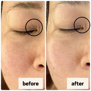 お肌と歯のサロン　Sona Mior所属・藤井 ののみのエステ・リラクイメージ