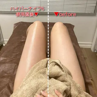 痩身サロンiBDY所属・いわきり ゆきのエステ・リラクイメージ