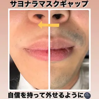 メンズ メンズ脱毛サロン Le falcoのエステ・リラクイメージ