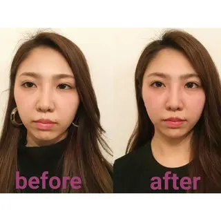 隆鼻矯正専門店ラプリ 佐藤のエステ・リラクイメージ