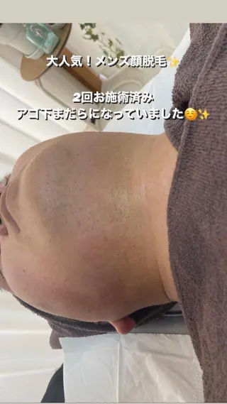 メンズ 都度払い制脱毛サロンBe Charm所属・Be Charm 山﨑のエステ・リラクイメージ