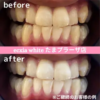 セルフホワイトニング　エクシアたまプラーザ店所属・セルフホワイトニング エクシアたまプラーザのその他イメージ