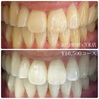 PLATINUM Beauty 横浜店所属・ホワイトニングルーム 横浜店のその他イメージ