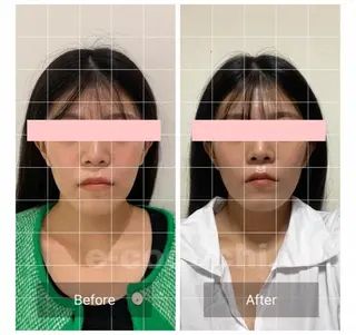 小顔と ヘッドスパのお店のエステ・リラクイメージ