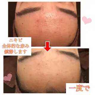 ロング カラー パーマ ヘアアレンジ メンズ キッズ ネイル マツエク・マツパ 四つ星サロン🎖 腸＆ニキビケアに特化のエステ・リラクイメージ