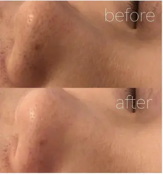 ✨美肌水光✨ アトリエリュバンのエステ・リラクイメージ