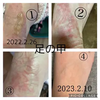 private salon  Dea_maris シュガーリング＆パーソナルボディケア所属・シミ改善・韓国肌管理 ボディメイク痩身のその他イメージ