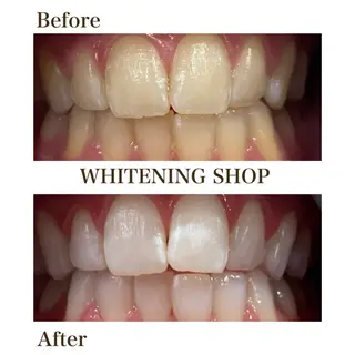 メンズ ホワイトニングショップ静岡葵区店所属・ホワイトニング ショップ静岡葵区店のその他イメージ