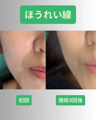 河輪 鍼灸接骨院のエステ・リラクイメージ