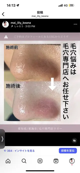 トータルビューティー サロンLilyのエステ・リラクイメージ