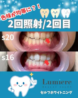 耳ツボジュエリー Lumiereのその他イメージ