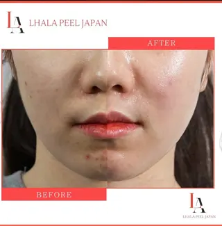 目元・まつパ・美肌フ ェイシャル谷町四丁目のマツエク・マツパデザイン