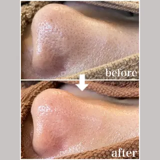 韓国肌管理 【毛穴専科】のエステ・リラクイメージ