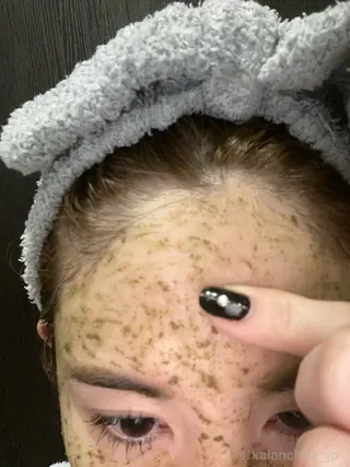 肌質改善 KALANCHOEのエステ・リラクイメージ