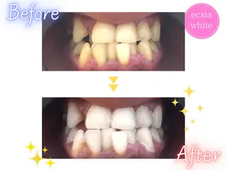 セルフホワイトニング エクシア渋谷駅西口店のその他イメージ