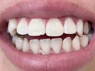 セルフホワイトニングサロン　ラヴィアン所属・ホワイトニングサロン La vie enのその他イメージ