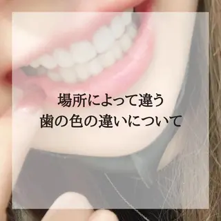 ライトビューティー 恵比寿店のその他イメージ