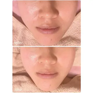 La Colzaのネイルデザイン