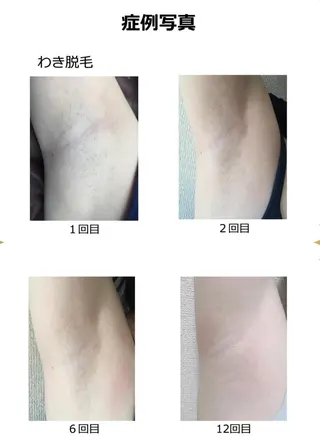 meravi所属・MERAVI 🫧🌿のマツエク・マツパデザイン