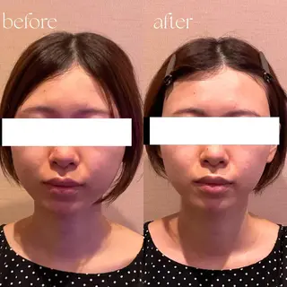 B-st. 下北沢のエステ・リラクイメージ