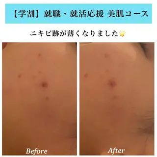 Bellesthe (ベルエステ)のエステ・リラクイメージ