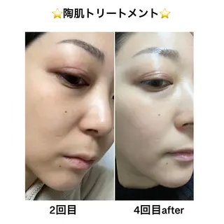 アロマ,陶肌 SalonYokoのエステ・リラクイメージ