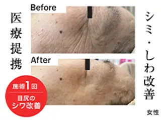 サロンドブリオン所属・Salon de Brillantのエステ・リラクイメージ