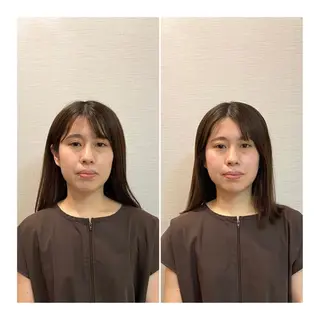 ロング 即小顔♥️美容鍼× ハーブピーリングのその他イメージ