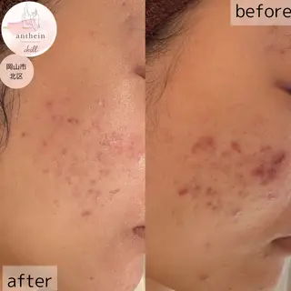 アンテインチル 山本のエステ・リラクイメージ