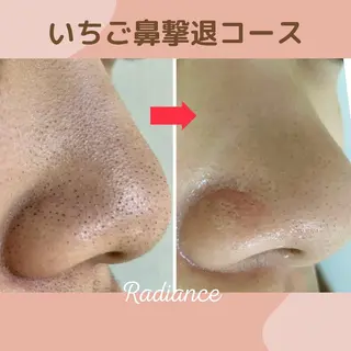 札幌ホワイトニング ラディアンス札幌駅店のその他イメージ