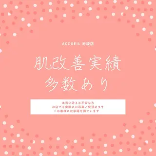 学生ニキビ改善🍀 優しい肌質改善のエステ・リラクイメージ