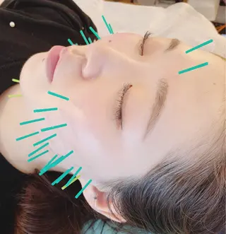 小顔美容鍼専門サロン 渋谷YZのエステ・リラクイメージ