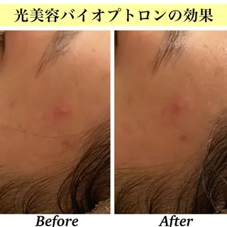 Bellesthe (ベルエステ)のエステ・リラクイメージ