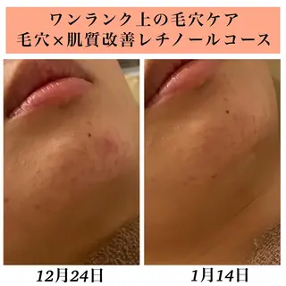 Bellesthe (ベルエステ)のエステ・リラクイメージ