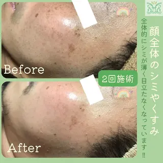 剥離するハーブ🌈 Honey Sideのエステ・リラクイメージ
