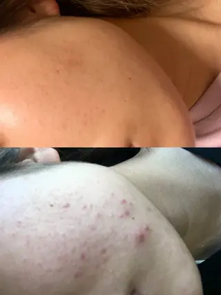 NARIS BEAUTY STATION　デ・アイム あべのルシアス所属・ニキビ跡/毛穴/ 肌質改善/北村ももこのエステ・リラクイメージ