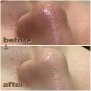 aroma  YURARI所属・韓国艶美人// 毛穴ケア🌹のエステ・リラクイメージ