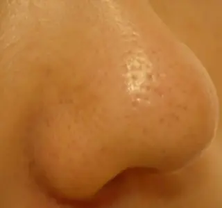 ピーリングサロン シャンテール所属・ピーリングサロン シャンテールのエステ・リラクイメージ